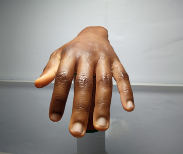 Nigerian artist makes dark skin prosthetics to boost patients' confidence