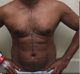 Doctor reveals African men are now doing cosmetic surgery for six-packs and ‘men boobs’